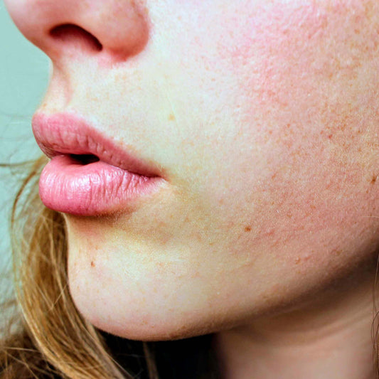 Upgrade Your Skincare Routine with Fate Skincare